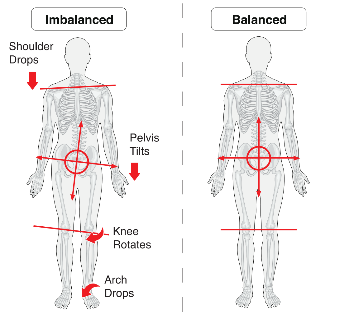 Balances VS Imbalanced